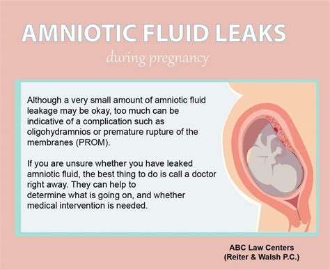 how do you know if your leaking amniotic fluid|Leaking amniotic fluid (premature rupture。